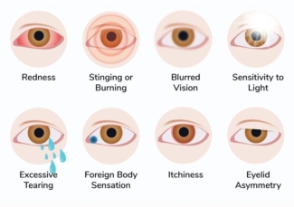 Dry eye symptoms